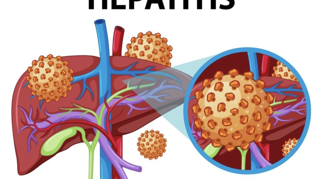 Mencegah Infeksi Hepatitis B dan C di Indonesia
